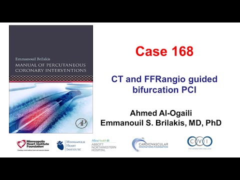 Case 168: Manual of PCI - CT and FFRangio guided PCI