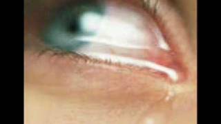 broken promise - placebo