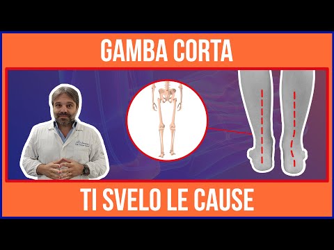 GAMBA CORTA e BACINO STORTO - TI Svelo le CAUSE 💥
