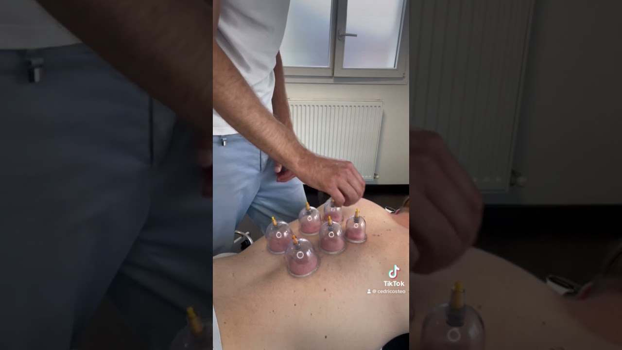 Ensemble de ventouses de massage, 12 Cupping video thumbnail