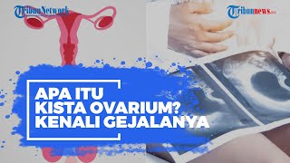 Apa itu Kista Ovarium?
