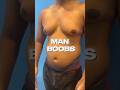 Gynecomastia, also known as “man boobs”, affects men by overgrowth of breast tissue. #manboobs