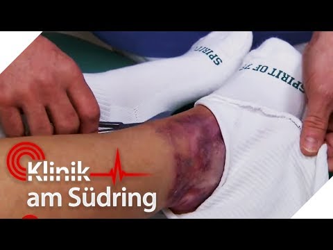 Gelenkschwellung des Kniegelenks Symptome der rheumatoiden Arthritis des Schultergelenkes