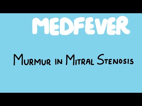 Why is Murmur heard in Mitral Valve Stenosis? Understand the pathophysiology.