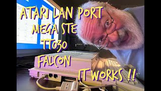 Atari LAN Port DOES WORK - TT030 - Mega STE - Falcon - Networking Atari via Apple LocalTalk Adapters
