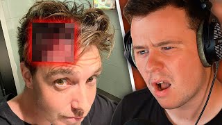 How Lazarbeam got attacked (full story)