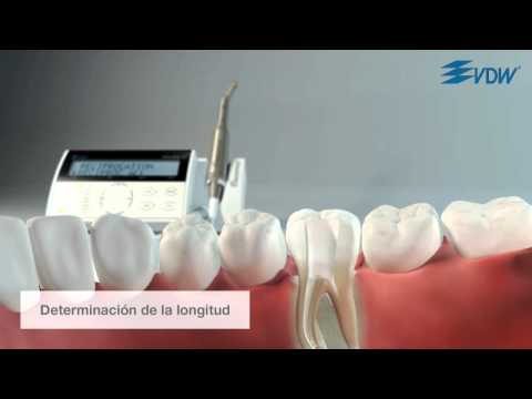 VDW Dental · RECIPROC 3/5 - El diseño del instrumento y el flujo de trabajo en un modelo 3D (ES)