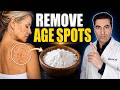 Dark Spots On Your Skin Baking Soda May Help Fade Them