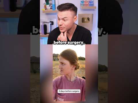 What REALLY Happens In A Double Jaw Surgery! 😬🦷