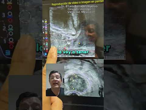 Efrain Barradas Huervo-36