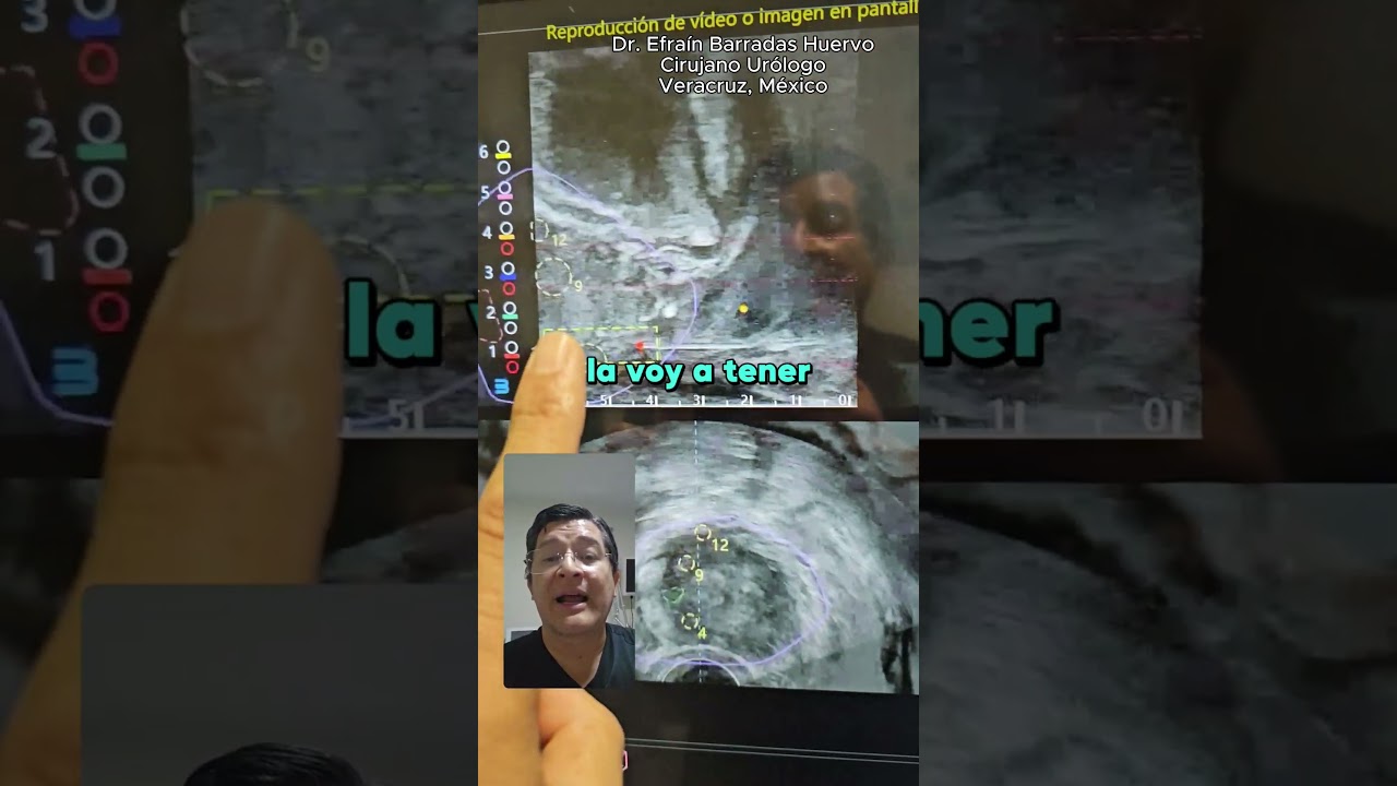 Efrain Barradas Huervo-36