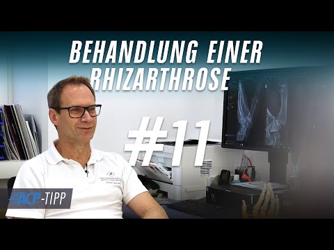 ACP-TIPP #11: Die Behandlung der Rhizarthrose / Daumensattelgelenksarthrose