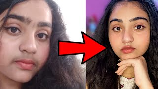 Teenage Facial Hair Removal with total Natural Ingredients ||How I removed my Facial Hairs Naturally