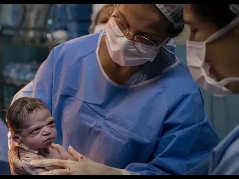 La naissance d'un nouveau-né très en colère contre le médecin!😱Santé Parfaite&Divertissement Video
