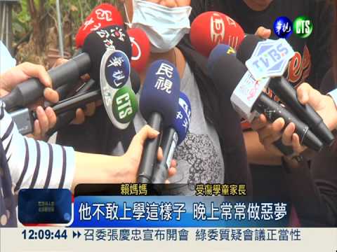 打同學遭罰蹲跳 童大腿肌肉拉傷