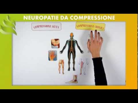 TEIP kinesis con lartrite del ginocchio Mal di testa nel collo dà