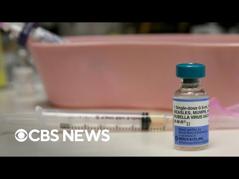 Putting the 33-year measles high in perspective