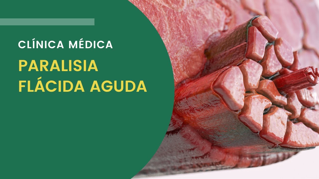 Paralisia Flácida Aguda