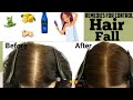 Simple Home Remedies To Prevent Hair Loss Grow Your Hair Faster MV Beauty Hub Hair Fall
