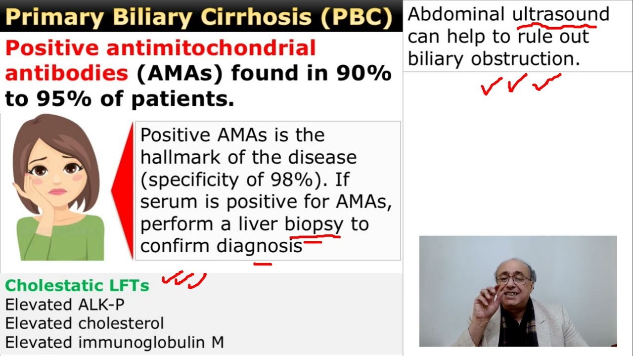 Primary Biliary Cirrhosis