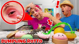 GIORGIA ROMPE UN DUMPLING SQUISHY SI IRRITA L'OCCHIO E FINISCE IN OSPEDALE! 