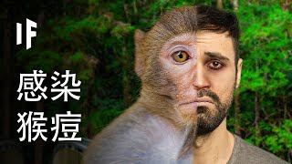 [問卦] 猴痘好像很嚴重只是因為看得到吧