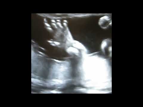 Planet Uterus - life