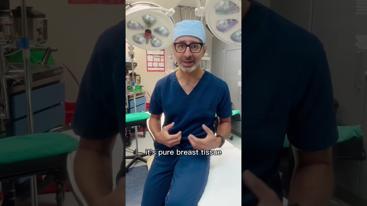 Gyno vs fat #beverlyhillsplasticsurgery #gynecomastia