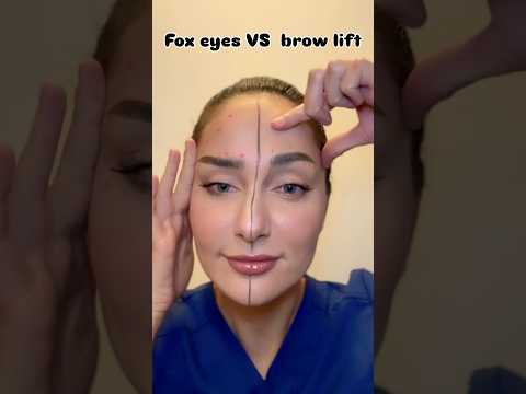 Brow Lift vs. Fox Eye – Where to Inject #botox Botox for Each Look