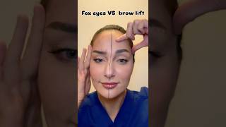 Brow Lift vs. Fox Eye – Where to Inject #botox Botox for Each Look