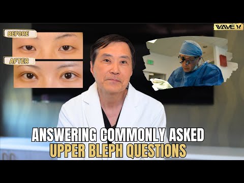 Upper Blepharoplasty Q&A: What You Need to Know