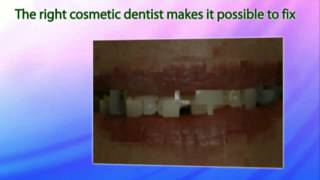 preview picture of video 'Best Cosmetic Dentist Rancho Santa Margarita'