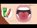 How to Heal a Bitten Tongue