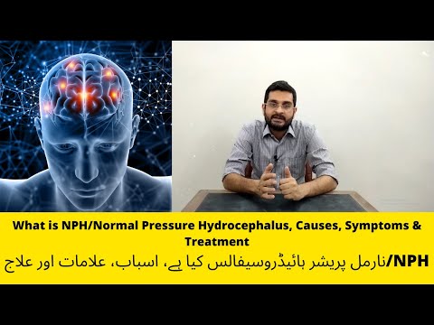 What is NPH/Normal Pressure Hydrocephalus, Causes, Symptoms & Treatment in Urdu/ Hindi