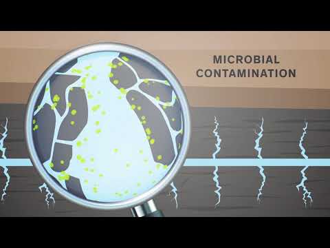 Why do I need a biocide in hydraulic fracturing operations?