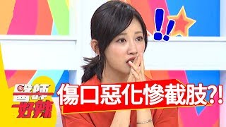 被「它」輕輕刺一下！傷口惡化慘截肢？！醫師好辣 20180801 part1 EP580 Terry 張振榕