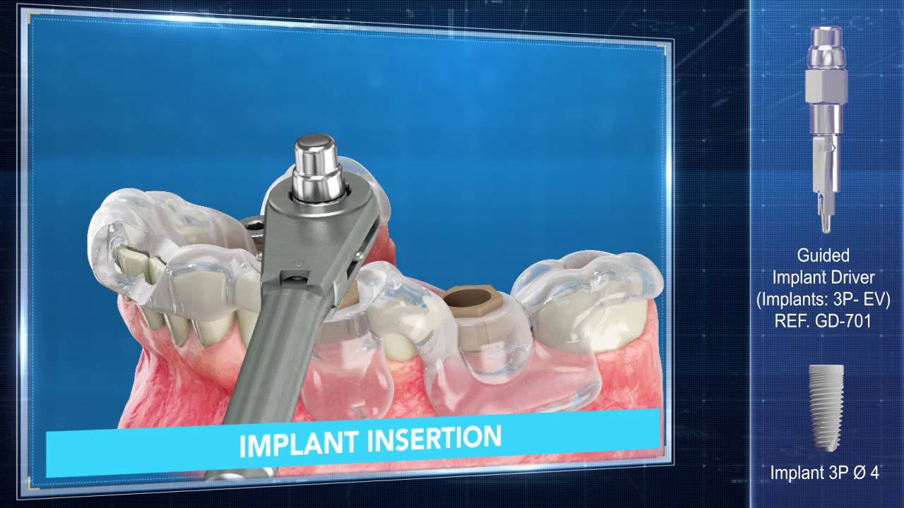 Постер видео