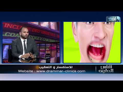 مقابلة — زراعة الفك بالكامل