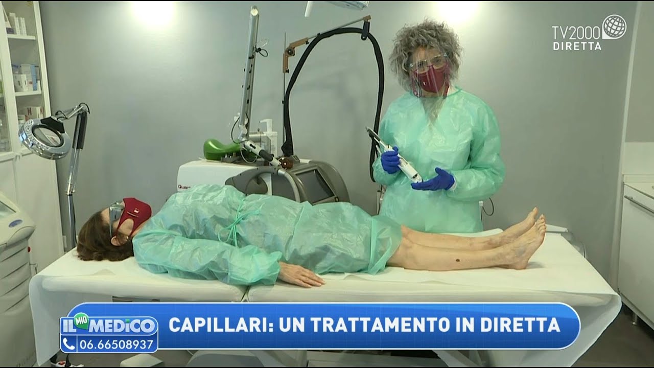I trattamenti per eliminare i capillari delle gambe