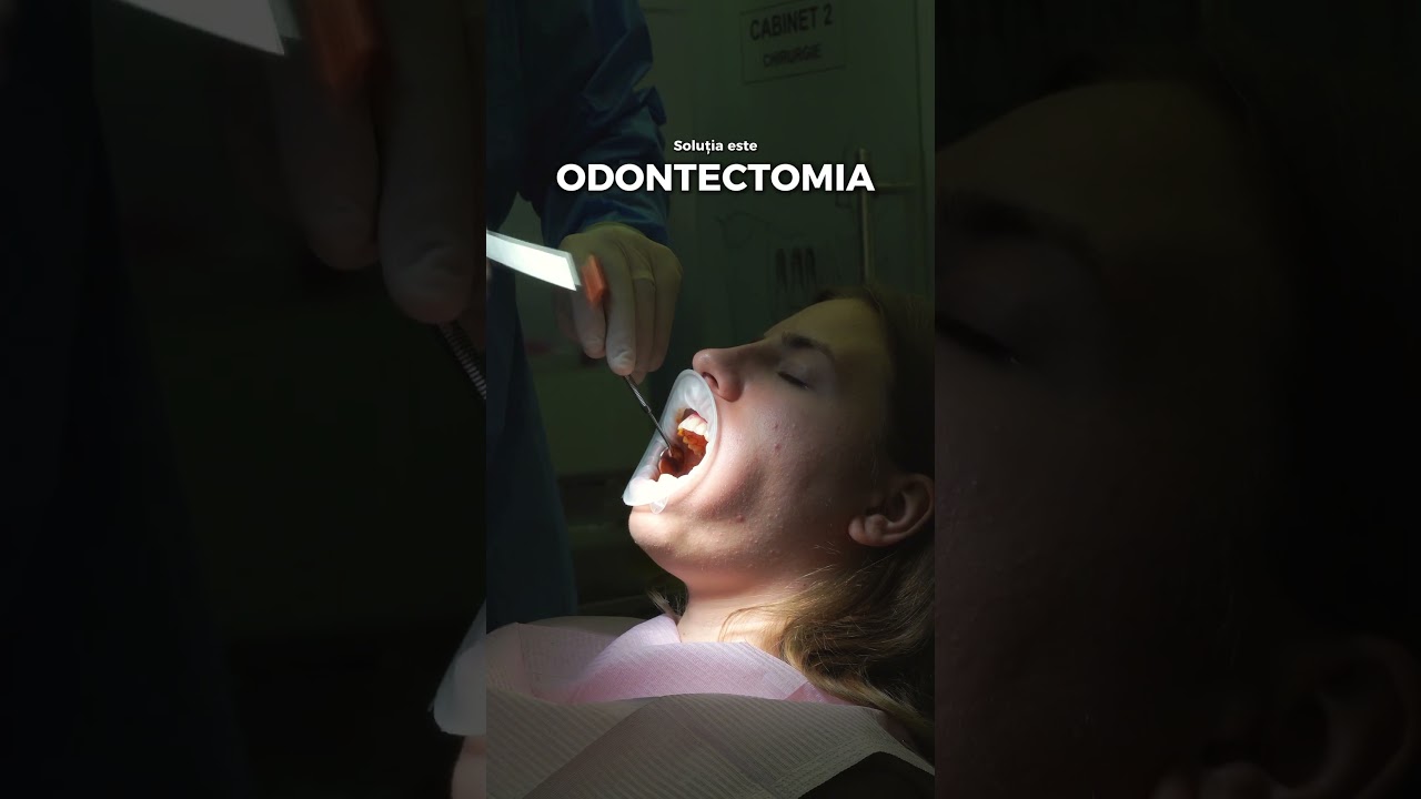 Despre Odontectomie