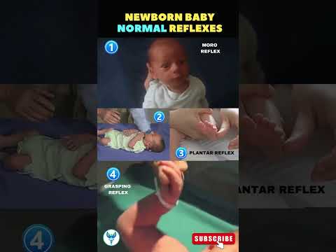 Newborn baby normal reflexes explained ✅ Moro reflex | Plantar reflex | Grasping reflex #reflexes