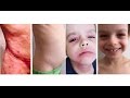 Les médecins ne croient pas la maman. Puis quand elle filme son fils et leur montre ÇA? Les docteurs sont sous le choc.
