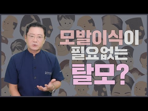 탈모 꼭 모발이식을 할 필요가 있을까요? 모발이식 필요한 경우 하지 말아야할 경우를 소개합니다.