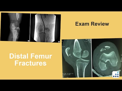 Distal Femur Fractures Exam Review - C. Lowry Barnes, MD