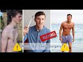 MY METAL BAR SURGERY STORY Documenting