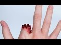 FIREWORKS BLOW OFF FINGER! FIREWORKS BLOW OFF FINGER!