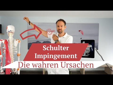 Shoulder impingement ⚡ - The real causes ➡️