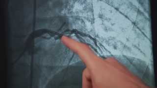Paoli Hospital  |  Jeff's Story