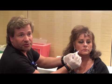 Redo Cleft Lip Repair Surgery