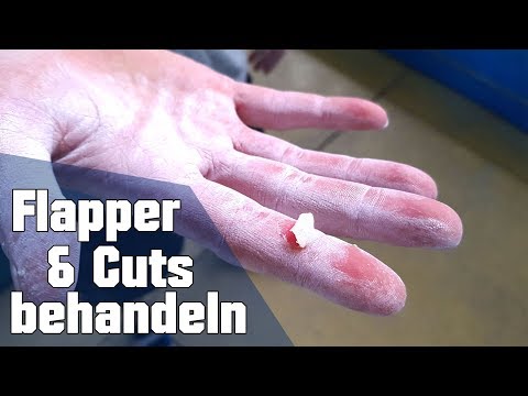 Hautverletzungen vom Bouldern und klettern verarzten